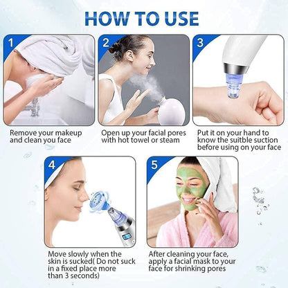 🌟 4 In 1 Multi-Function Blackhead Remover Tool 🌟