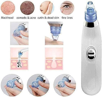 🌟 4 In 1 Multi-Function Blackhead Remover Tool 🌟