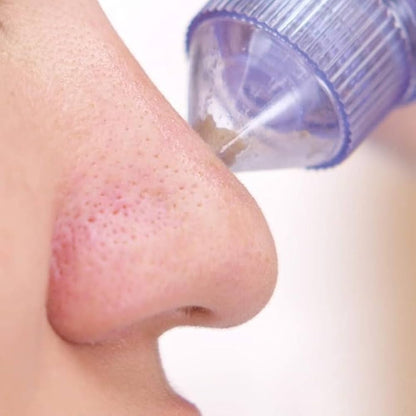 🌟 4 In 1 Multi-Function Blackhead Remover Tool 🌟