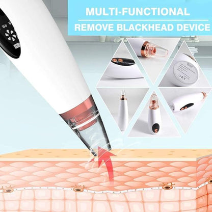 🌟 4 In 1 Multi-Function Blackhead Remover Tool 🌟