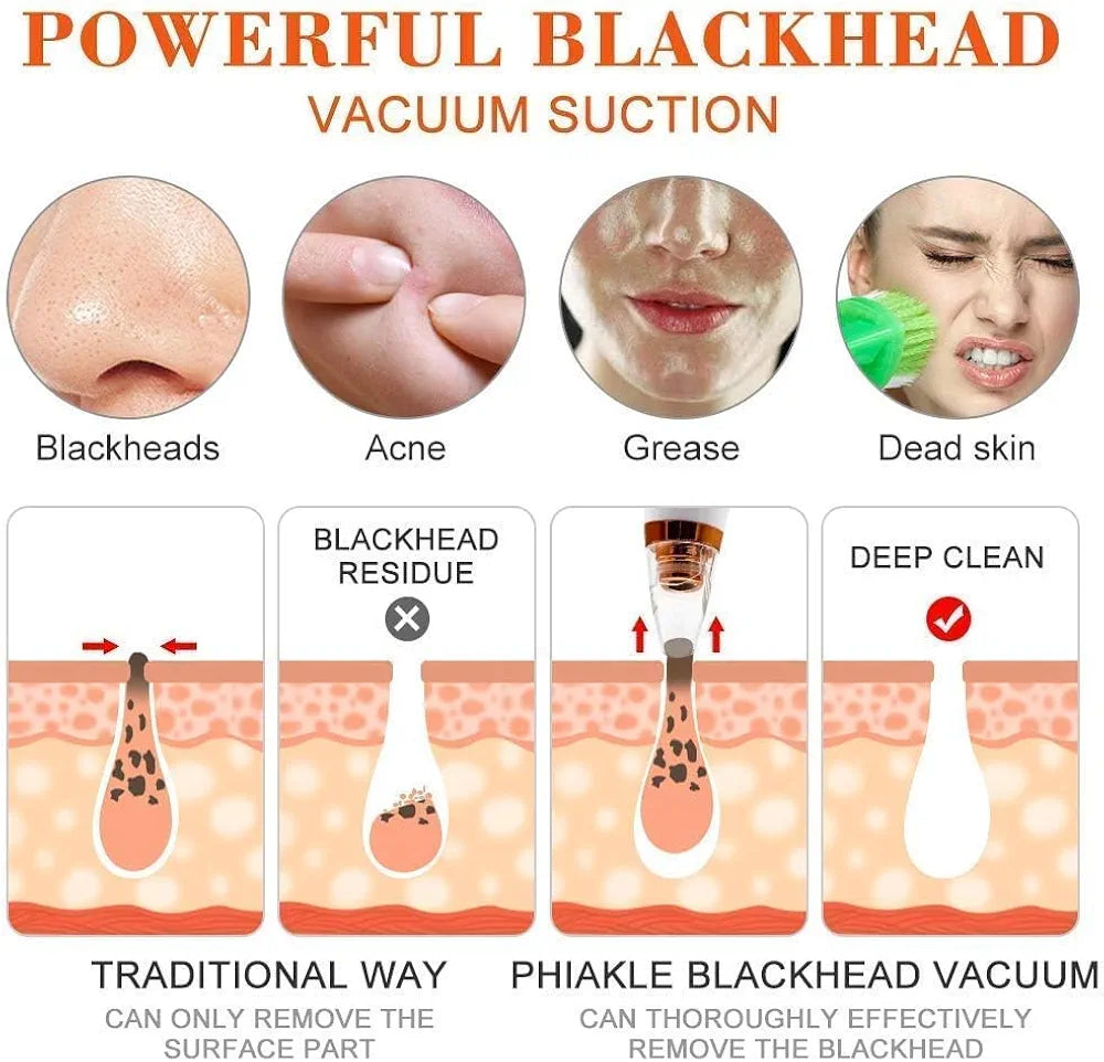 🌟 4 In 1 Multi-Function Blackhead Remover Tool 🌟